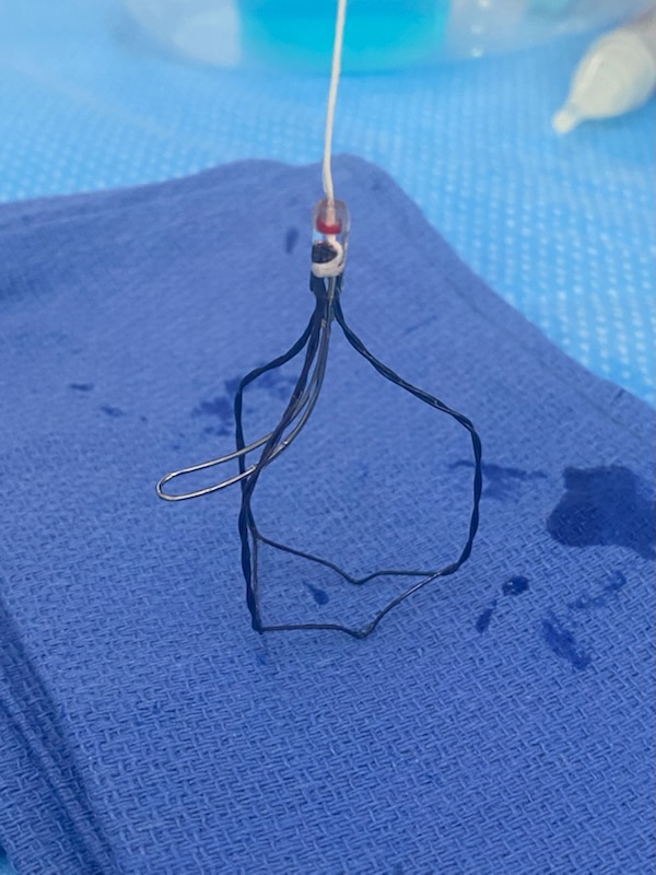 iTind device fully expanded, close-up