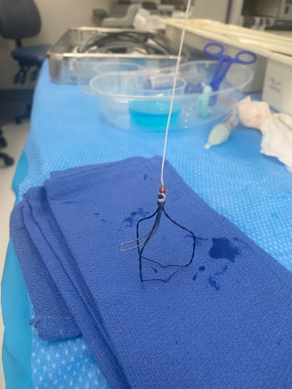 iTind device in the operating theatre at the Mater Hospital