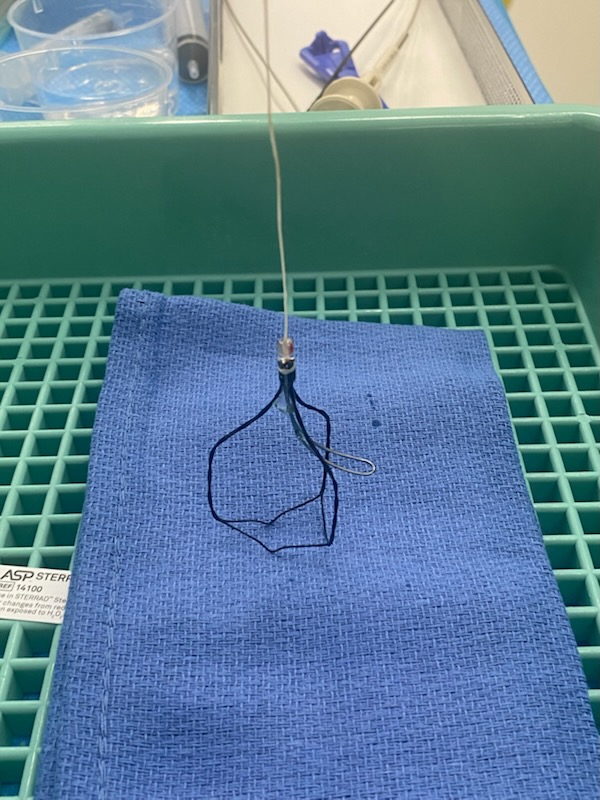 iTind device expanded, shown on a sterile drape in the sterilisation tray at the Mater Hospital